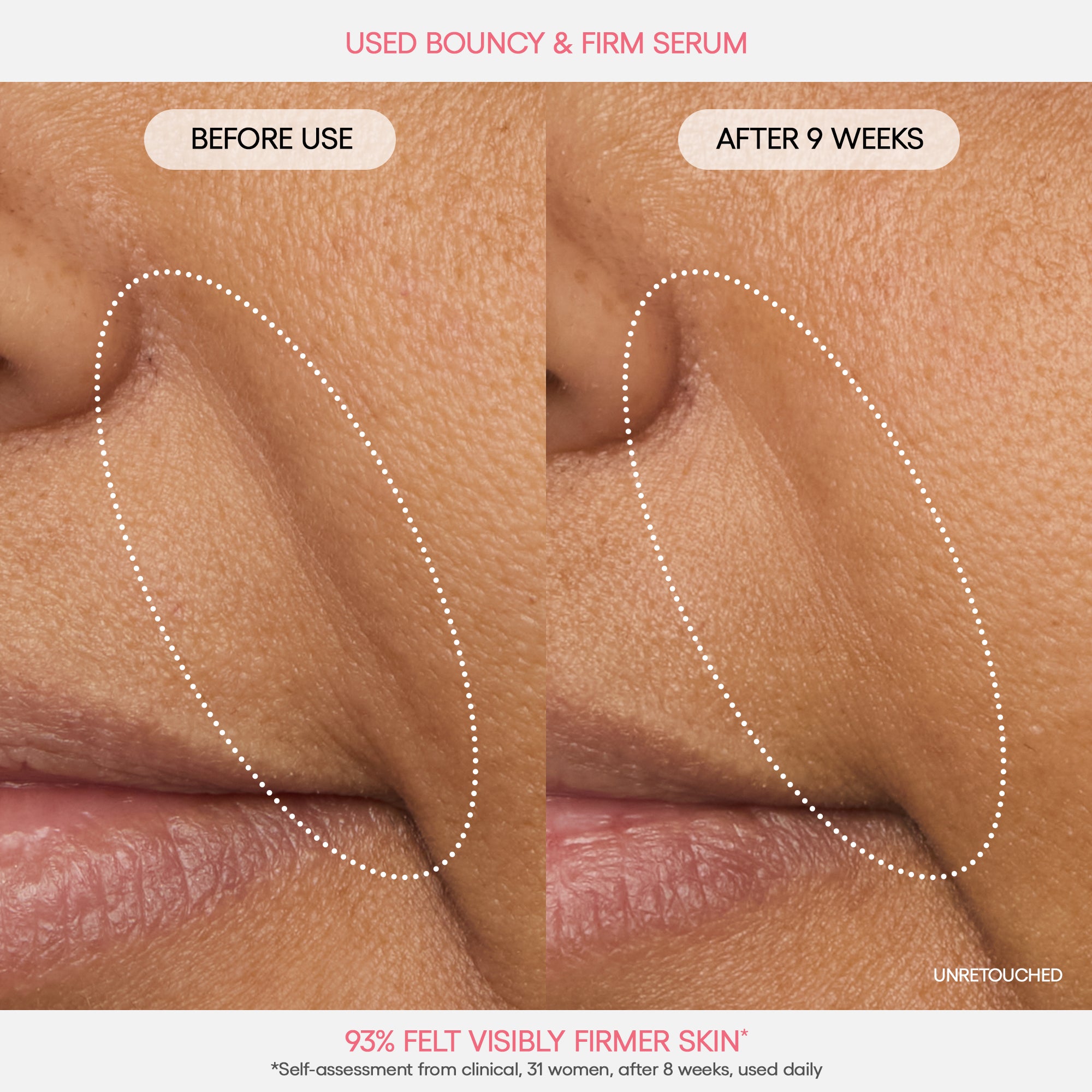 Alternative view of Bouncy & Firm Serum
